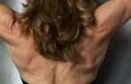 back fat problems
