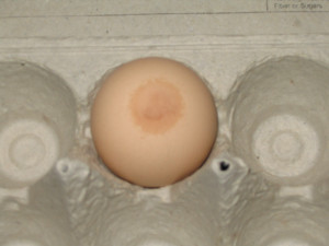 Nipple Madness: What Normal?
