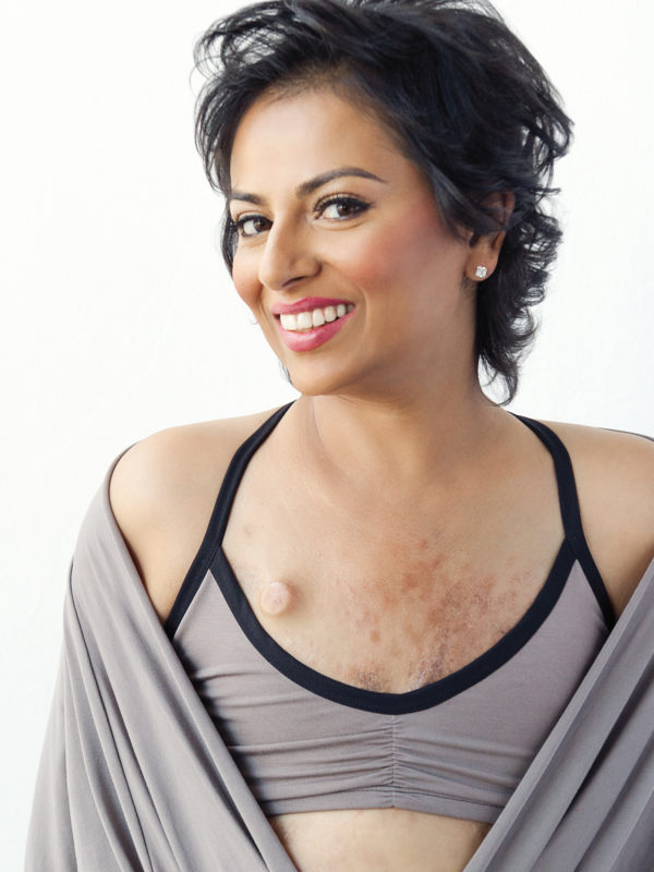 unreconstructed breasts