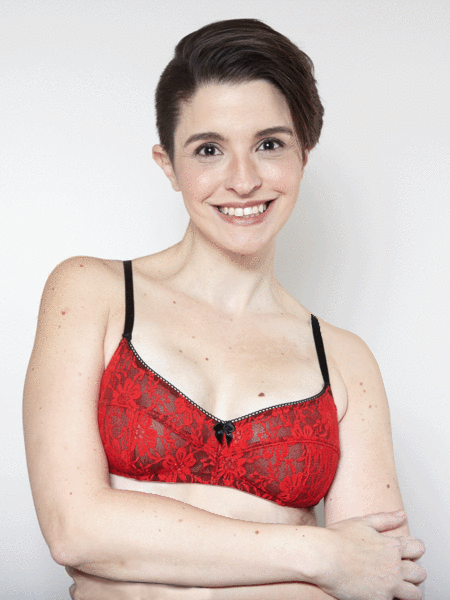 breast reconstruction
